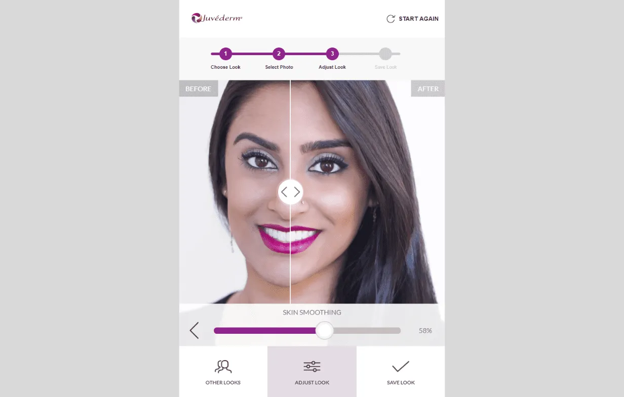 Juvéderm: Visualizing the results of facial cosmetic treatments